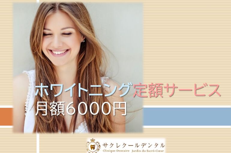 ホワイトニング定額サービスブログ用１